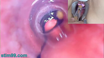 tube porn carnal clinic